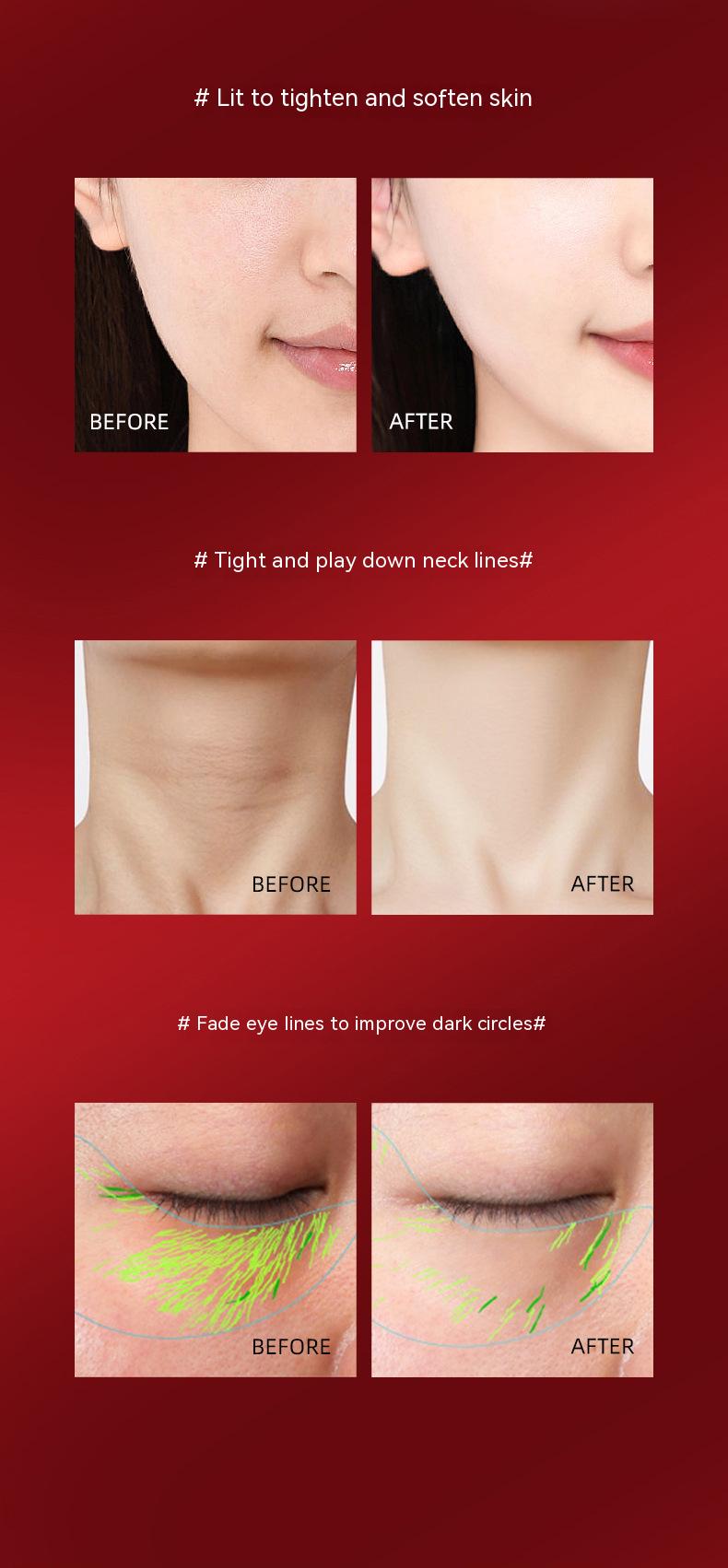 COOLBABY HQQ-WDTL Photonic Micro-sculpture Lifting And Tightening Beauty Instrument Red Warm Blue Vibration USB Rechargeable Import Instrument - COOL BABY